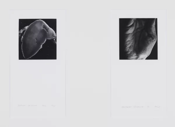Balthasar Burkhard — 2 Werke: Hand, 1991/92