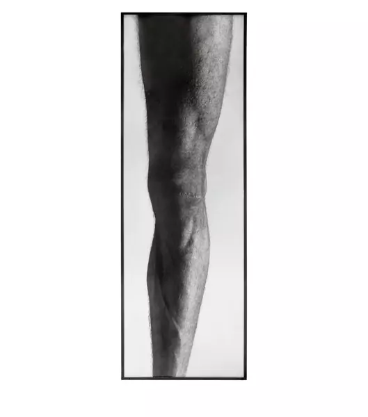 Balthasar Burkhard — Das Knie — Galerie Kornfeld