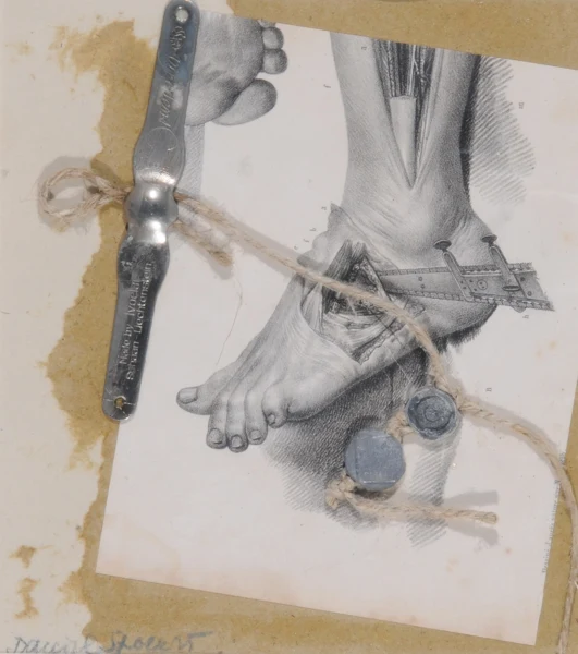 Daniel Spoerri — La médicine opératoire dessinée d'après nature par N. H. Jacob (1839), 1993