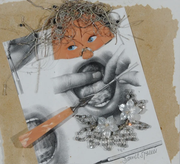 Daniel Spoerri — Ohne Titel, aus "La médicine opératoire dessinée d'après nature par N.N. Jacob (1839), 1993/1994