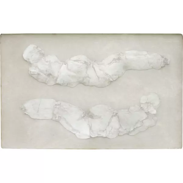 Jürgen Brodwolf — Zwei Liegende II — Galerie Kornfeld
